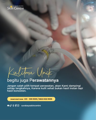 PostPhoto