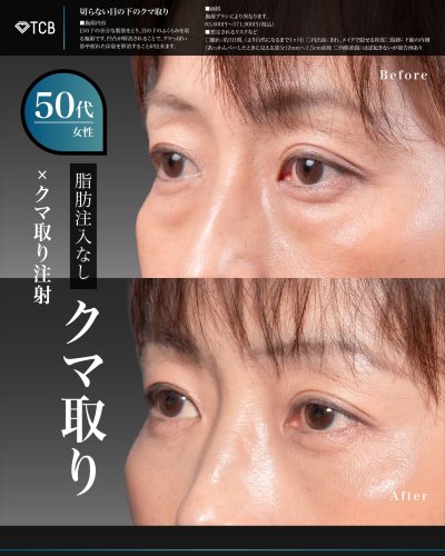 Carousel post from tcb_okamoto_takuya_shorei.