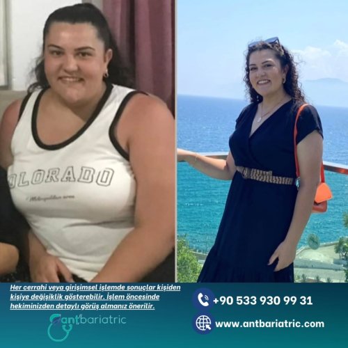 Photo post from antbariatric.