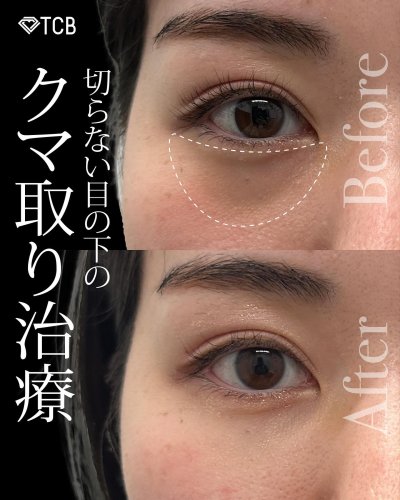 Carousel post from tcb_kihara_shunsuke.