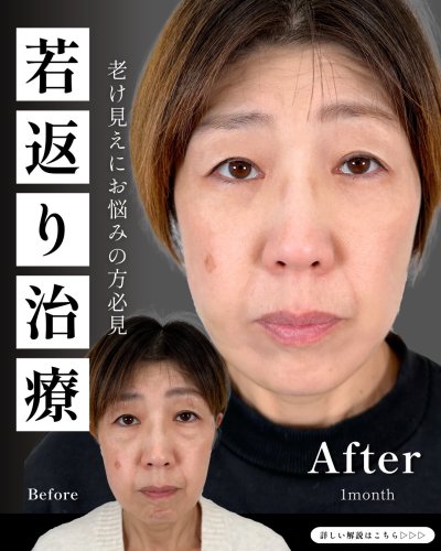 Carousel post from tcb_hashimoto.