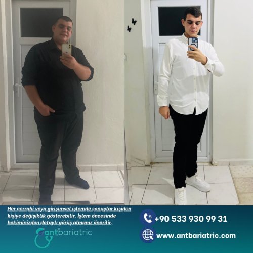 Photo post from antbariatric.