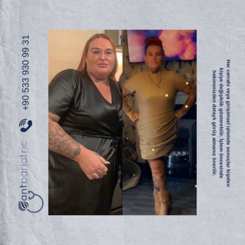 Photo post from antbariatric.