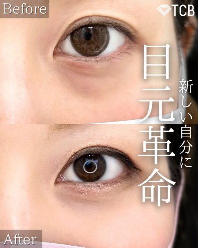 Carousel post from tcb_kihara_shunsuke.