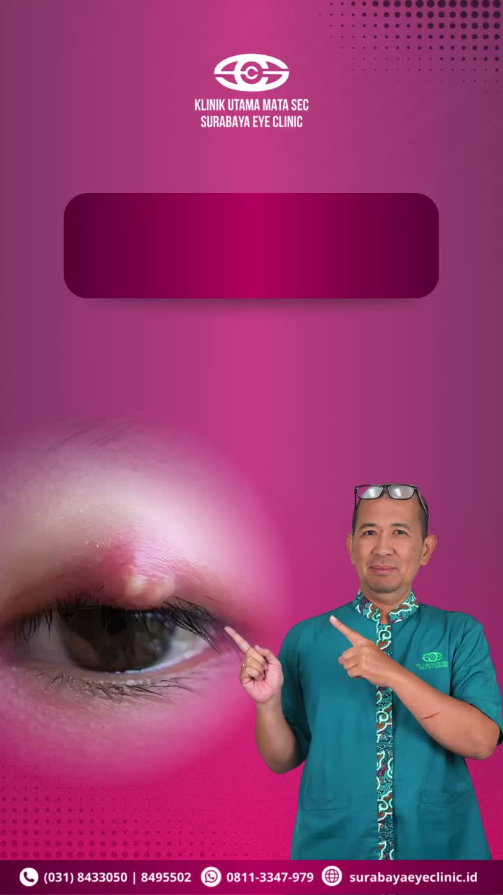 PostPhoto