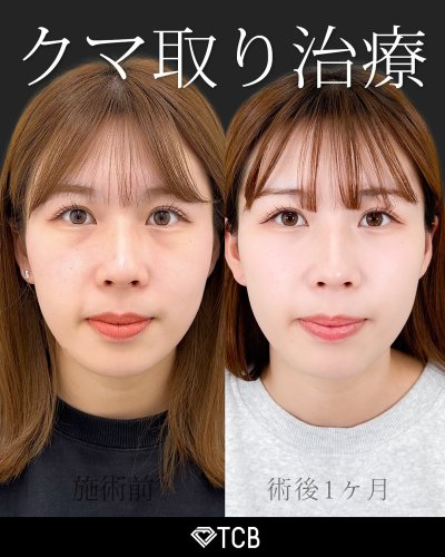 Carousel post from tcb_yamaguchi.s.