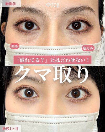 Carousel post from tcb_kakihana.