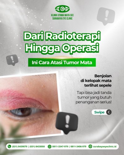 PostPhoto