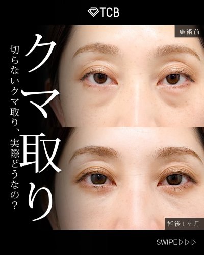 Carousel post from tcb_yamaguchi.s.