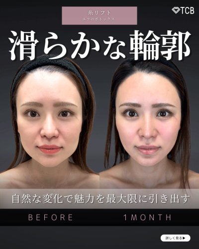 Carousel post from tcb_kamata.