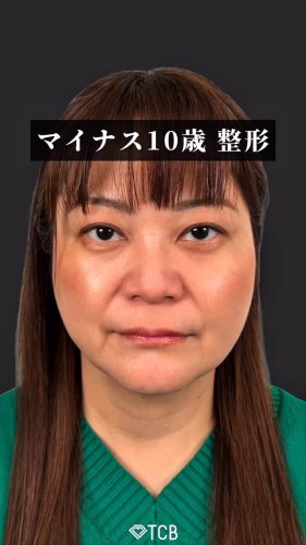 医療ハイフ（HIFU） | リフトアップはTCB東京中央美容外科