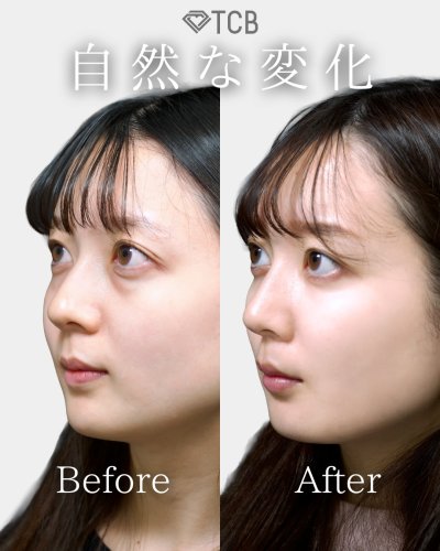 Carousel post from tcb_nakamura_hiroshi.