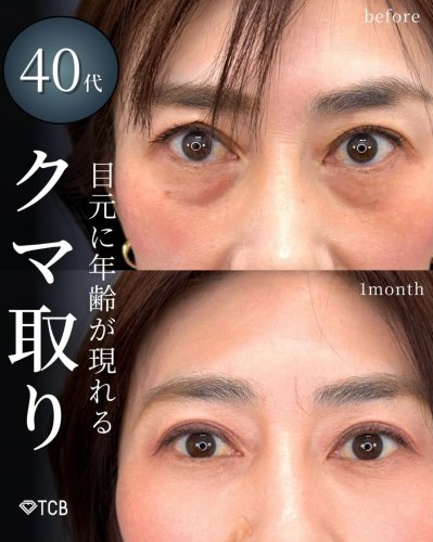 Carousel post from tcb_okuma.