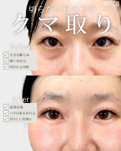 Carousel post from tcb_nakamura_hiroshi.