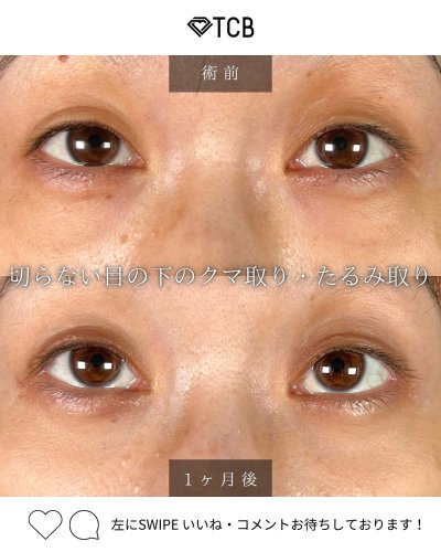 Carousel post from tcb_yukihiko.