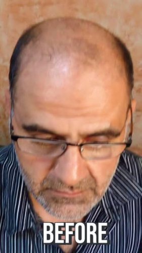 Video post from mondialhaircenter.