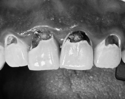Photo post from trilliumdental.