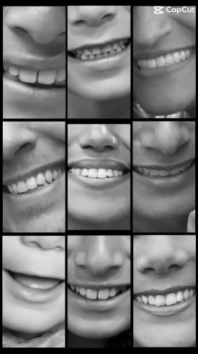 Video post from trilliumdental.