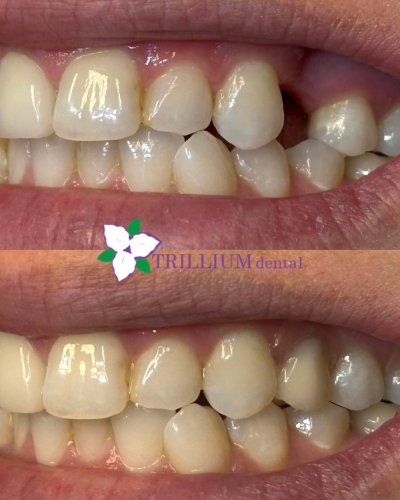 Photo post from trilliumdental.