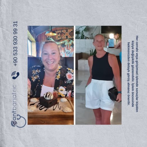 Photo post from antbariatric.