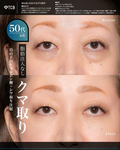 Carousel post from tcb_okamoto_takuya_shorei.