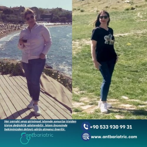 Photo post from antbariatric.