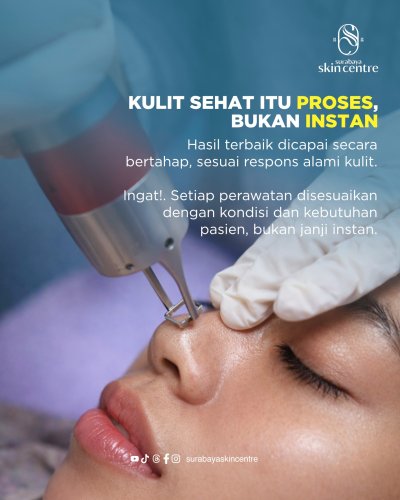PostPhoto