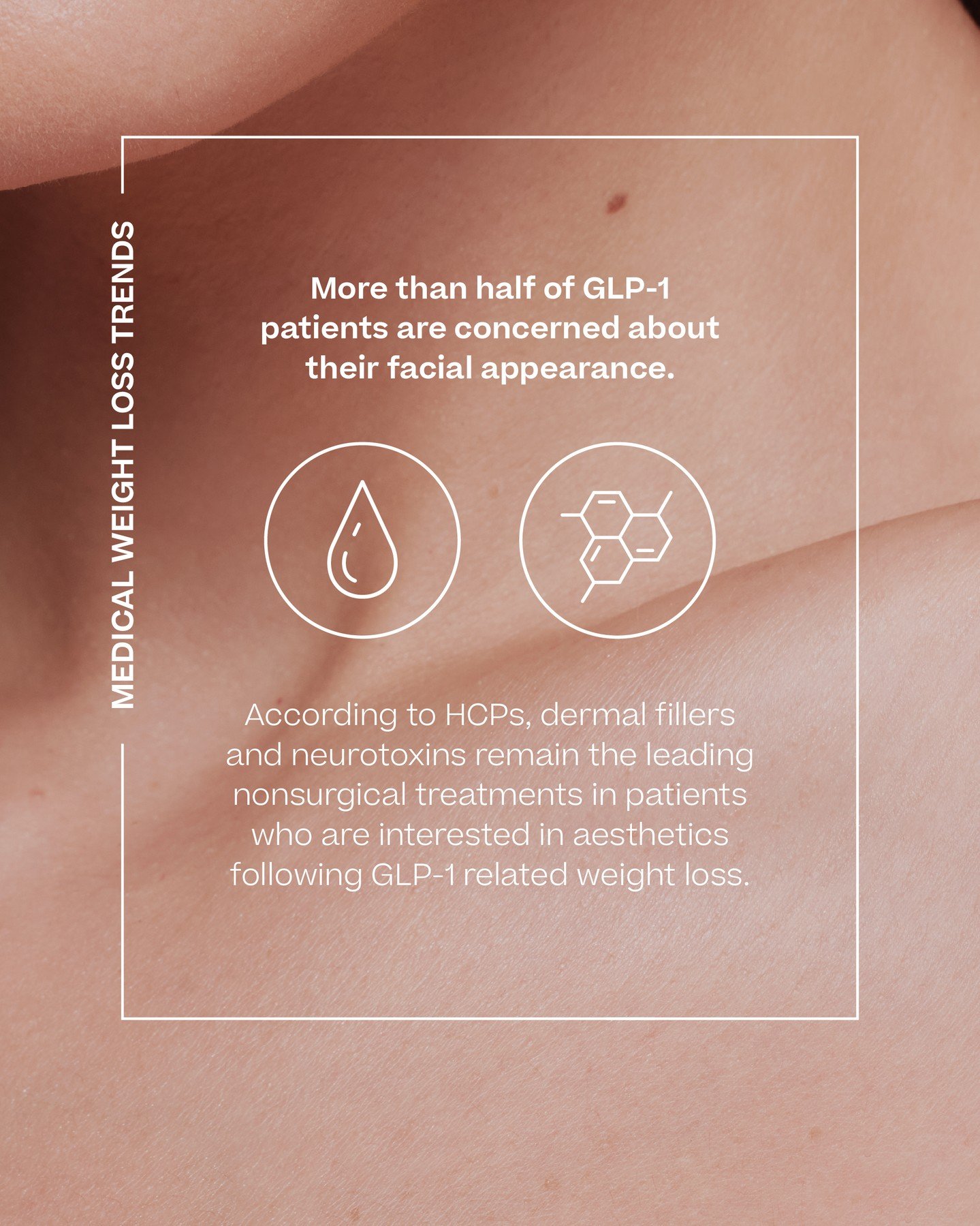 Allergan Aesthetics | An AbbVie Company
