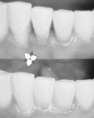 Photo post from trilliumdental.