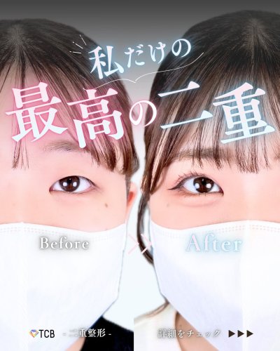 Carousel post from tcb_tsukuba.