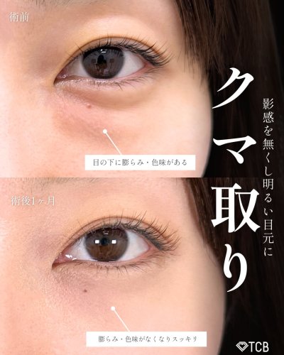 Carousel post from tcb_hashimoto.