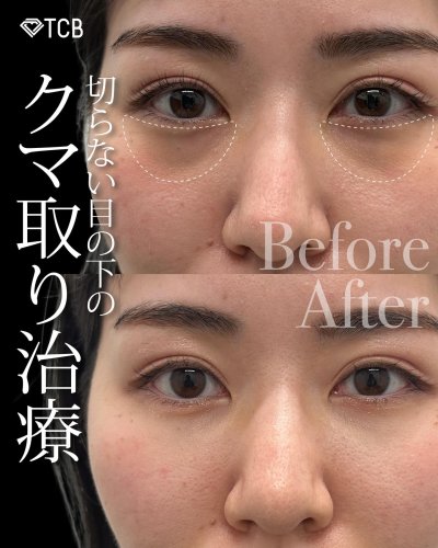 Carousel post from tcb_okuda_shingo.