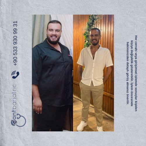 Photo post from antbariatric.