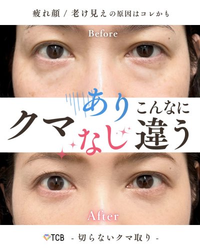 Carousel post from tcb_tsukuba.