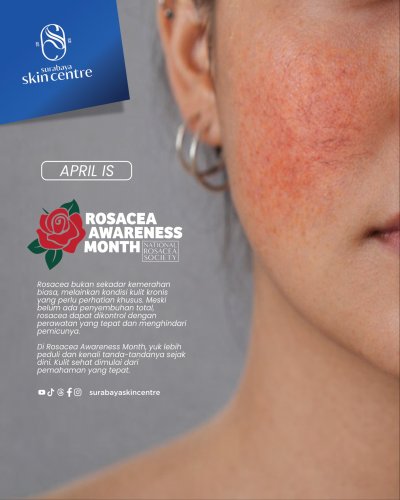 PostPhoto