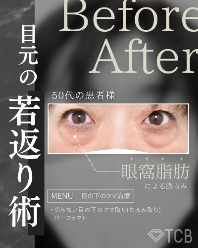 Carousel post from tcb_noda.