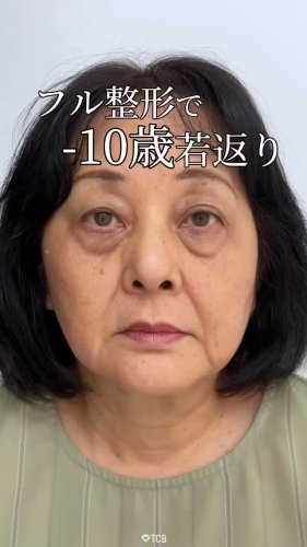 Video post from tcb_terato.