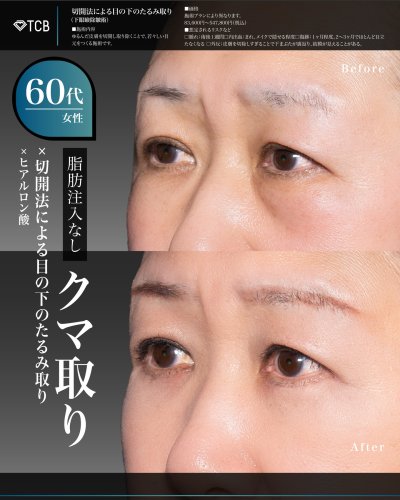 Carousel post from tcb_okamoto_takuya_shorei.