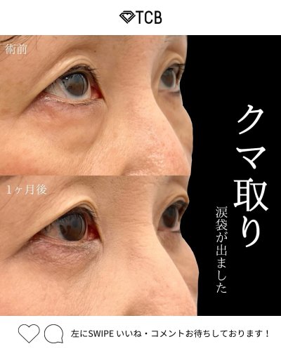 Carousel post from tcb_yukihiko.