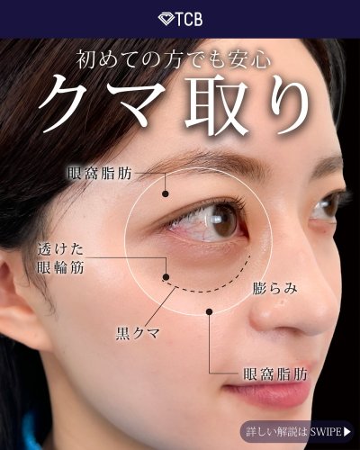 Carousel post from tcb_yamaguchi.s.