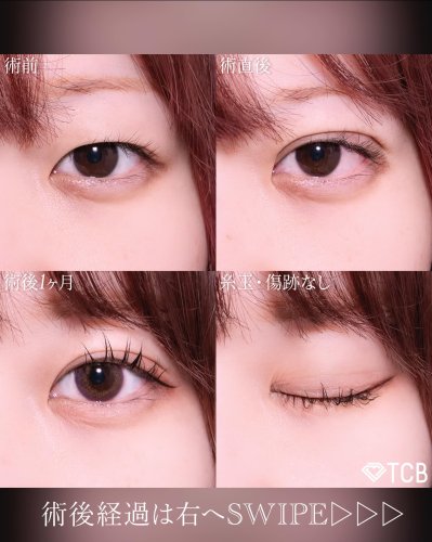 Carousel post from tcb_takayanagi.