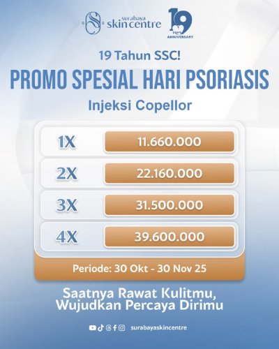 PostPhoto