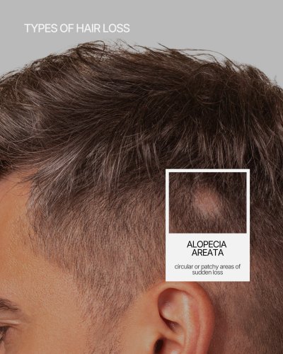 Carousel post from kerafactor.