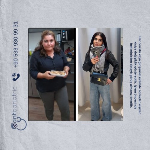 Photo post from antbariatric.