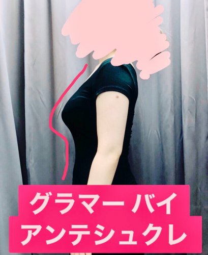 PostPhoto