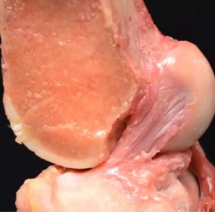 Video post from myphysiocpd.