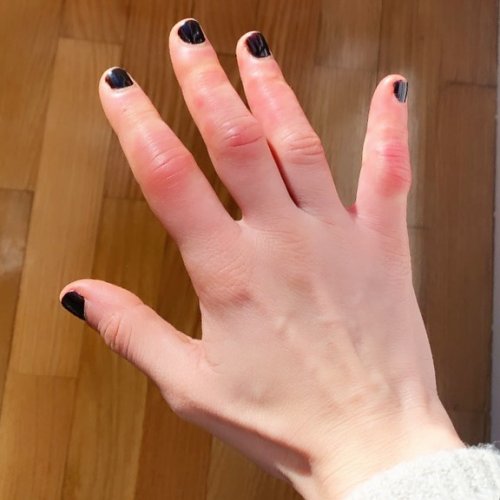 Photo post from apelequehabitoblog.