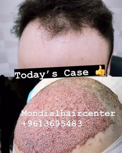 Photo post from mondialhaircenter.