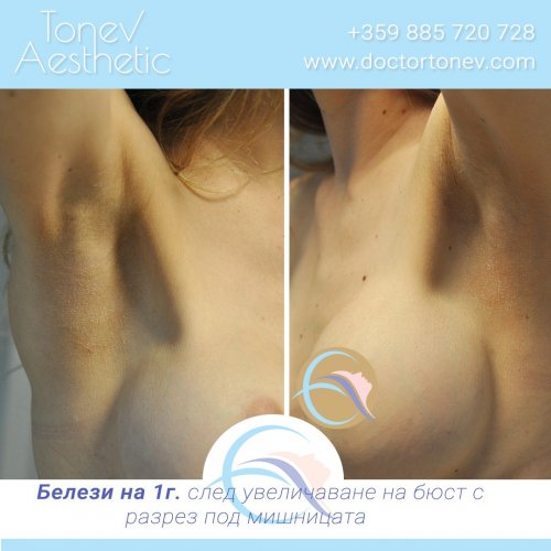 Photo post from dr.tonev.