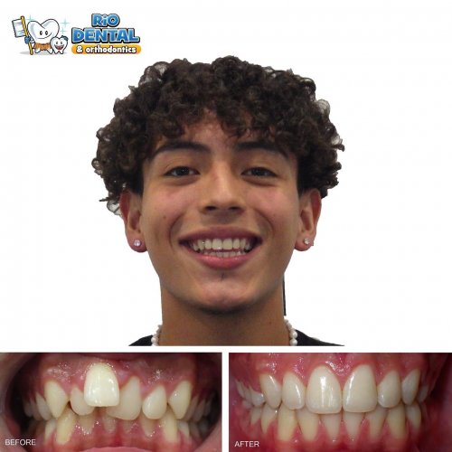 Photo post from rio_dental.